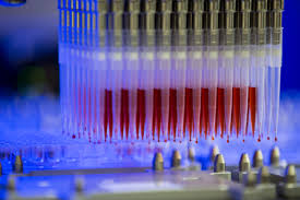 تولید واکسن برای کرونا ویروس چقدر طول خواهد کشید؟